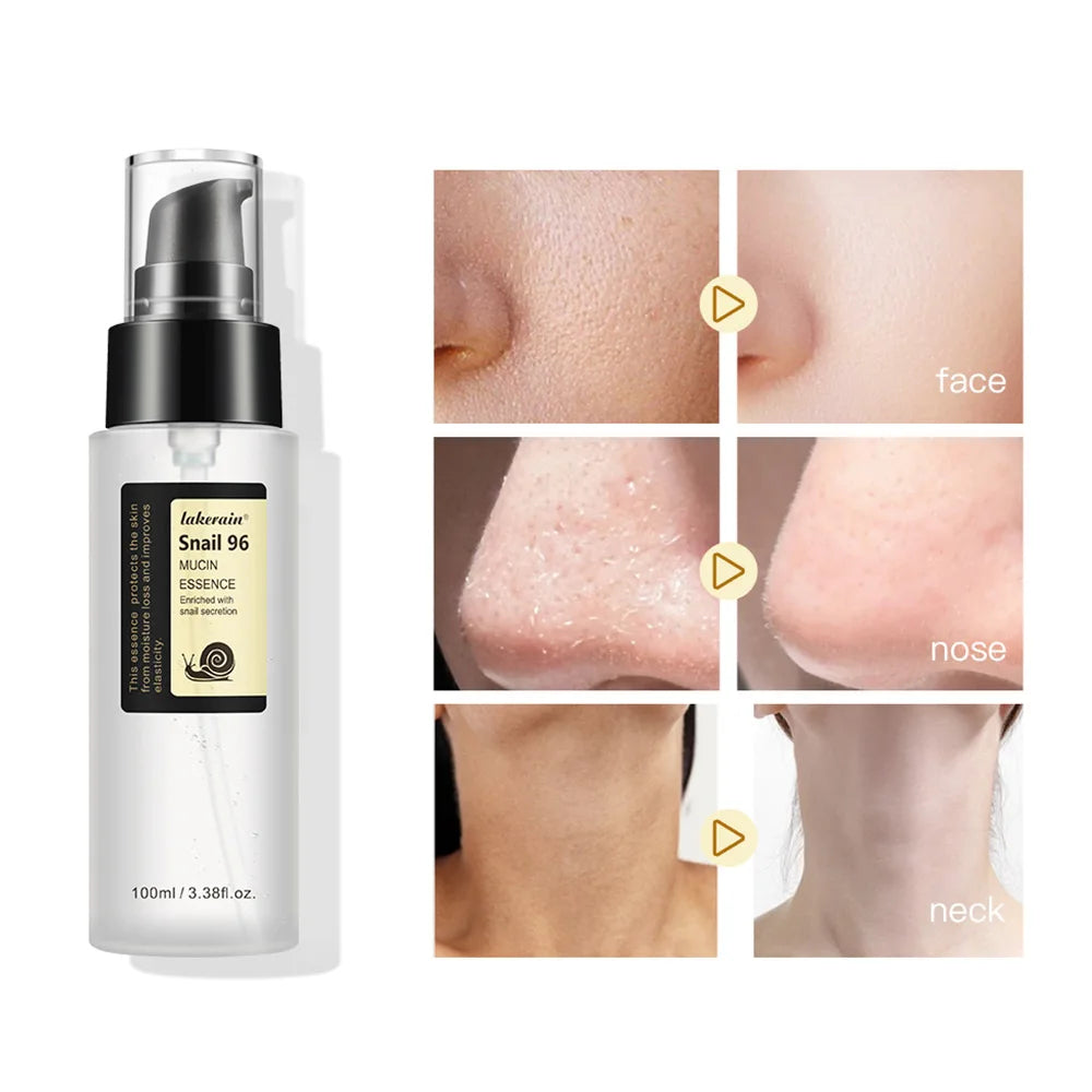 Anti-aging  Snail Serum