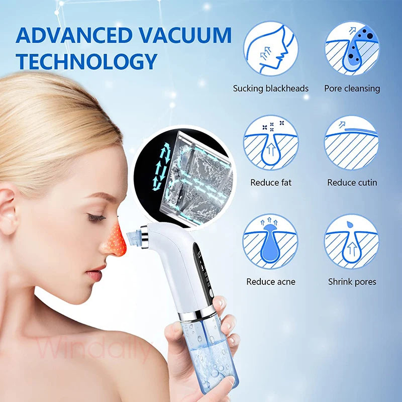 Blackhead Pore Vacuum Cleaner